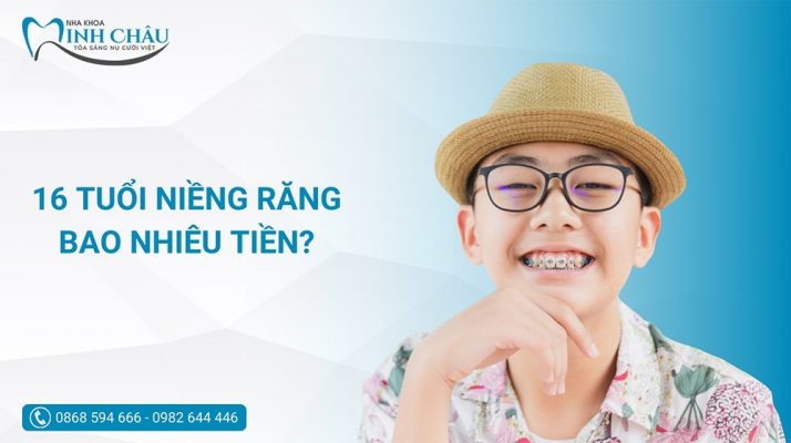 16 tuổi niềng răng bao nhiêu tiền? Mất bao lâu mới hoàn thành?