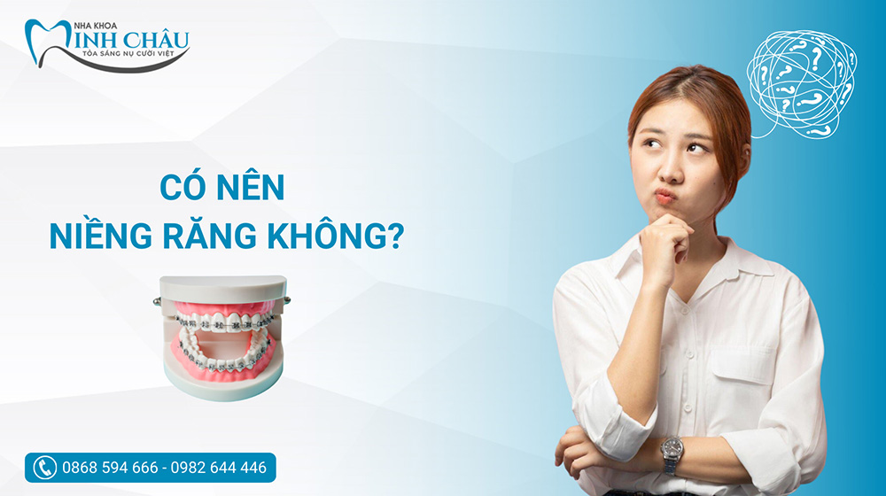 Có nên niềng răng không? Những phương pháp niềng răng phổ biến nhất hiện nay