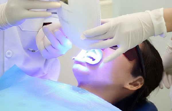 Tẩy trắng răng bằng công nghệ Whitening tại Nha khoa Minh Châu