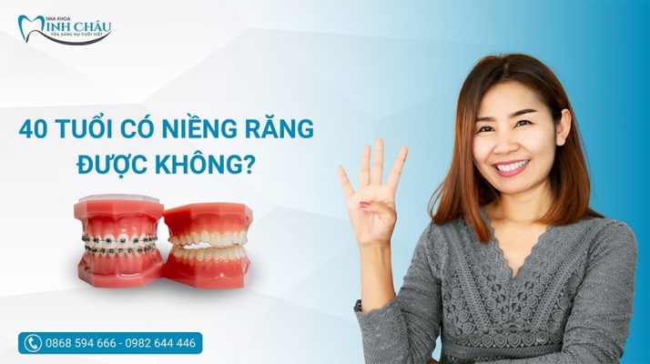 40 tuổi có niềng răng được không? Phương pháp niềng nào hiệu quả nhất?