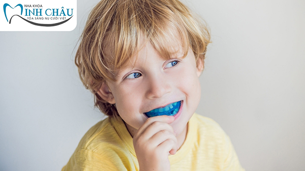 Trẻ em bao nhiêu tuổi thì nên niềng răng? 