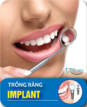 trồng răng implant