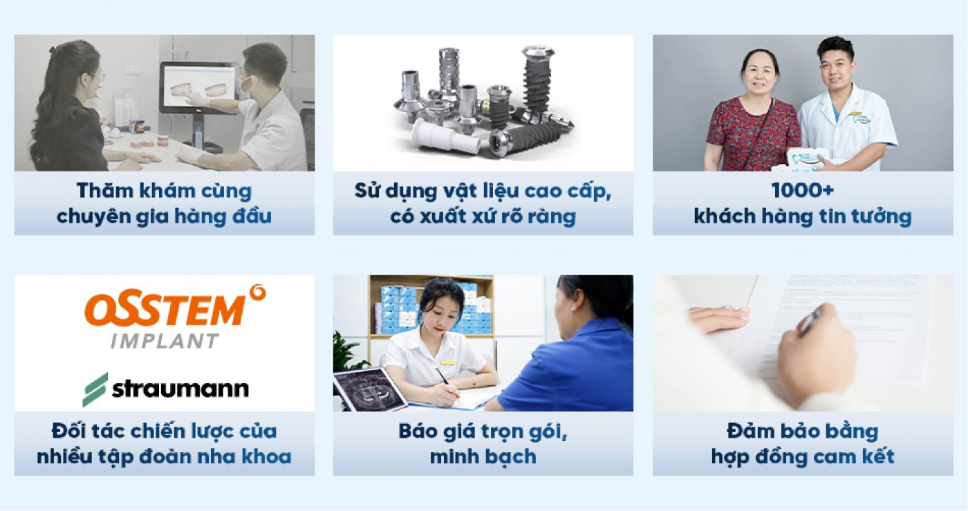 6 lý do bạn nên lựa chọn Nha Khoa Minh Châu