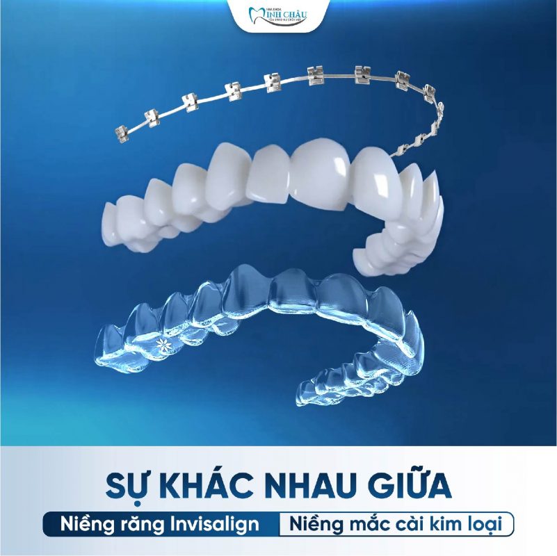 Niềng Răng Invisalign