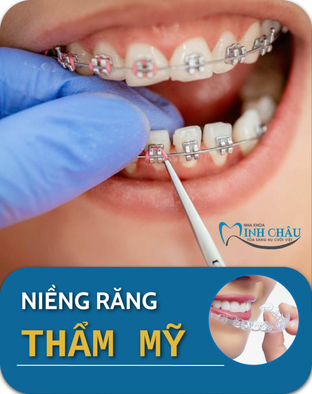 Nha khoa Minh Châu