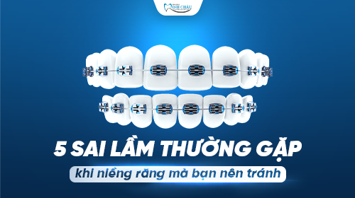 5 Sai Lầm Thường Gặp Khi Niềng Răng Và Giải Pháp Hiệu Quả Tại Nha Khoa Minh Châu