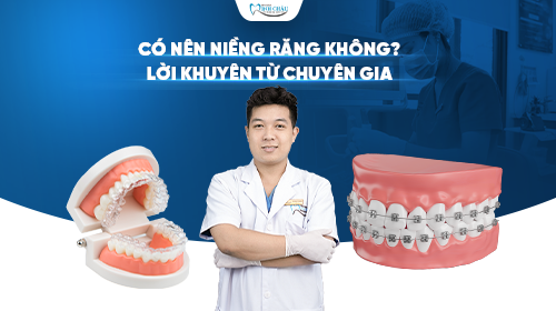 CÓ NÊN NIỀNG RĂNG KHÔNG? LỜI KHUYÊN TỪ CHUYÊN GIA