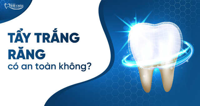 TẨY TRẮNG RĂNG CÓ AN TOÀN KHÔNG? GIẢI ĐÁP CHUYÊN SÂU TỪ NHA KHOA MINH CHÂU