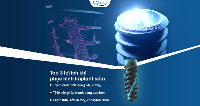 Phục Hình Implant