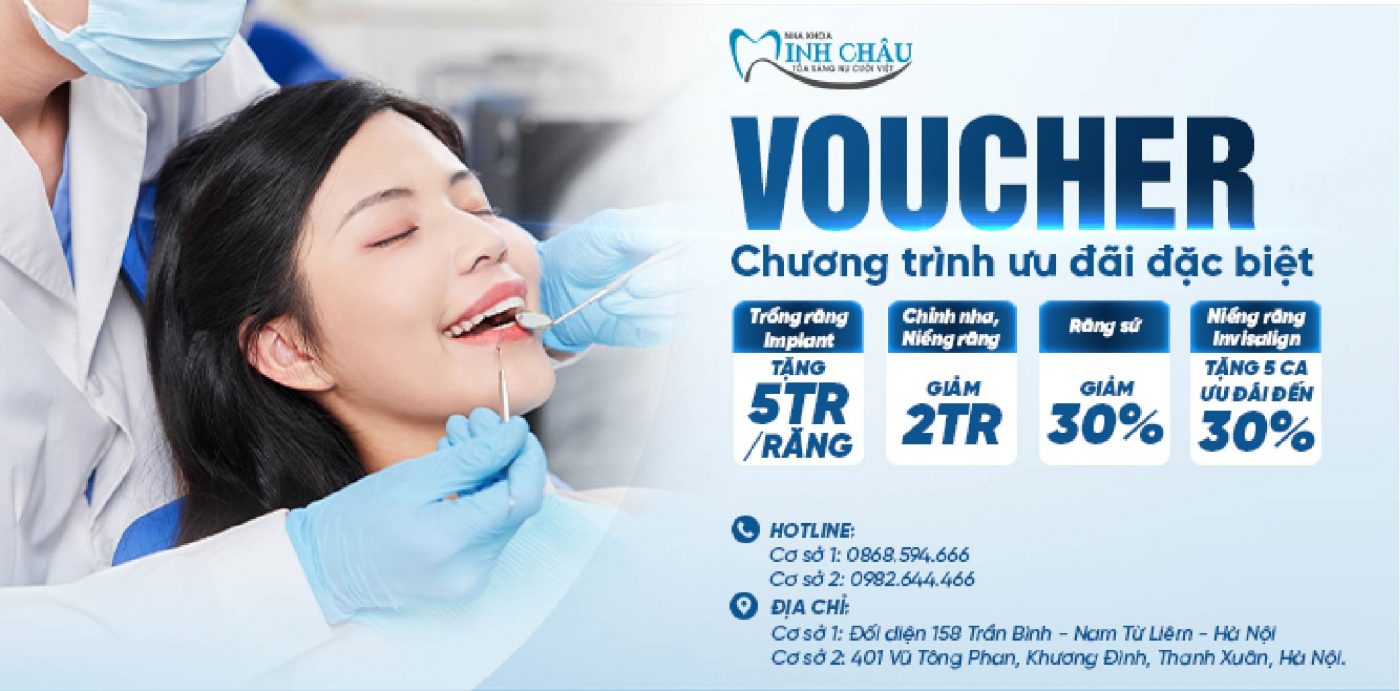 MỪNG XUÂN 2024 - NHA KHOA MINH CHÂU TẶNG VOUCHER KHỦNG CHO KHÁCH HÀNG