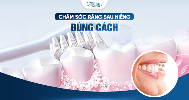 CHĂM SÓC RĂNG MIỆNG