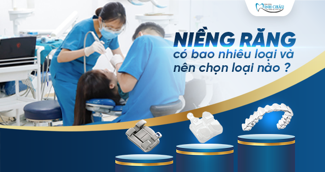 Niềng Răng Có Bao Nhiêu Loại và Nên Chọn Loại Nào?