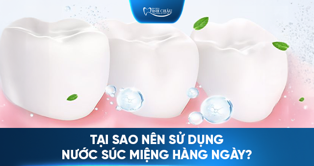 Nước Súc Miệng