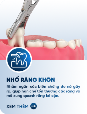 nhổ răng khôn