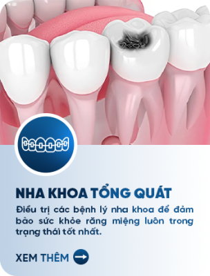 nha khoa tổng quát