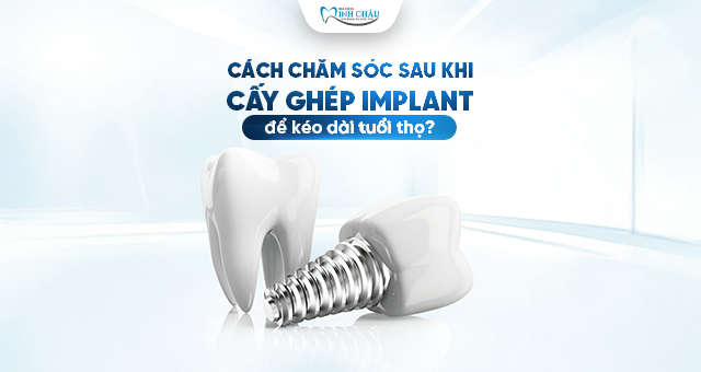 cấy ghép Implant