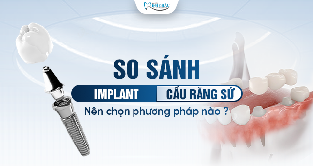 cấy ghép implant và làm cầu răng sứ