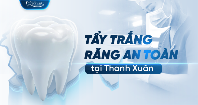 Tẩy trắng răng an toàn tại Thanh Xuân