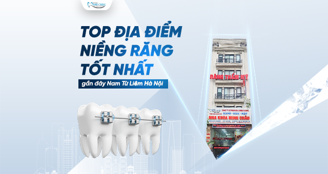 Nha Khoa Minh Châu – Địa Chỉ Niềng Răng Uy Tín Tại Nam Từ Liêm