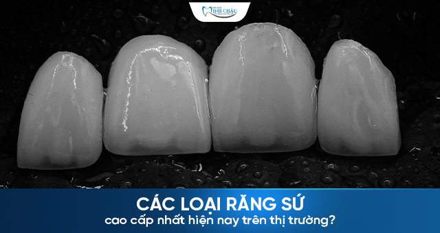 Các loại răng sứ cao cấp nhất hiện nay trên thị trường