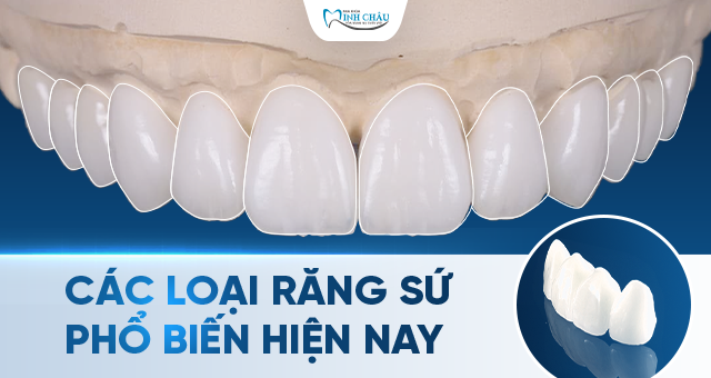 Các loại răng sứ phổ biến hiện nay