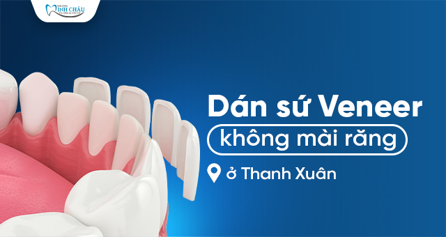 Dán sứ Veneer không mài răng ở Thanh Xuân