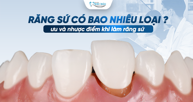 Răng sứ có bao nhiêu loại