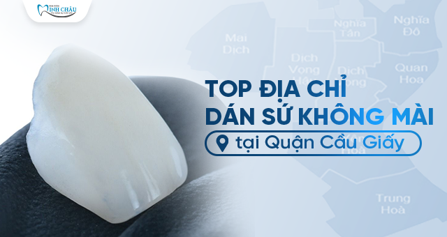Top địa chỉ dan sứ không mài tại Quận Cầu Giấy