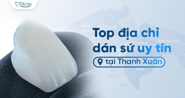 Top địa chỉ dán sứ uy tín tại thanh xuân