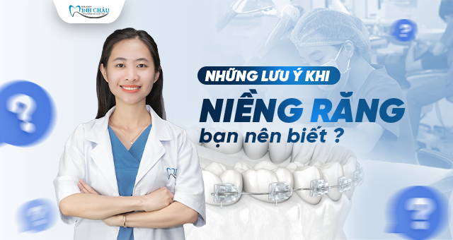những lưu ý khi niềng răng bạn nên biết