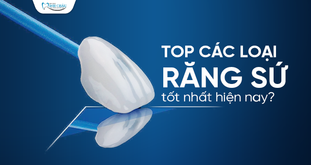 top các loại răng sứ tốt nhất hiện nay
