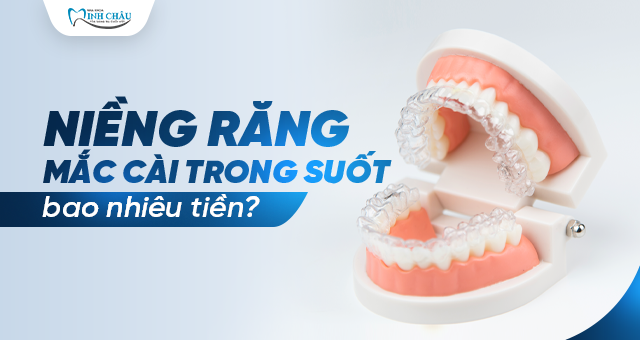 Niềng răng mắc cài trong suốt bao nhiêu tiền