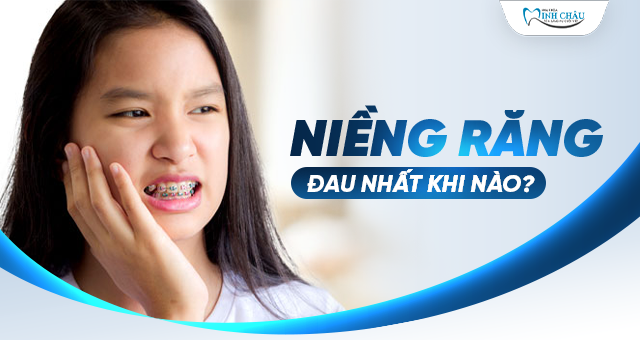 niềng răng đau nhất khi nào?