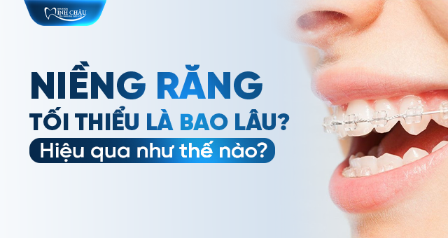 Tìm hiểu thời gian niềng răng tối thiểu và hiệu quả tại Nha khoa Minh Châu. Đội ngũ bác sĩ giỏi, dịch vụ hiện đại, cam kết nụ cười hoàn hảo.