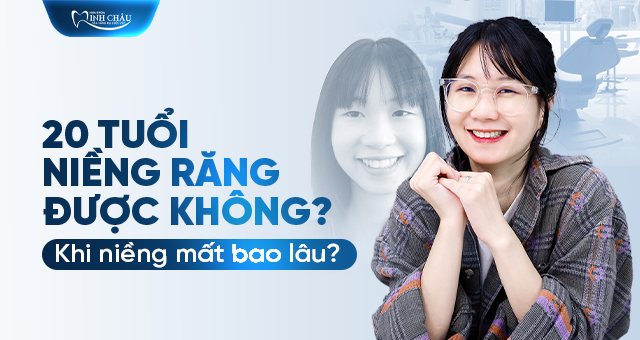 20 tuổi niềng răng được không? Niềng mất bao lâu thì đẹp?