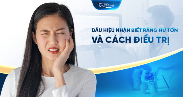 Dấu hiệu răng hư tổn & cách điều trị an toàn tại Minh Châu