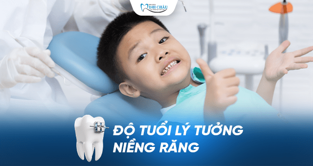 độ-tuổi-lý-tưởng-niềng-răng