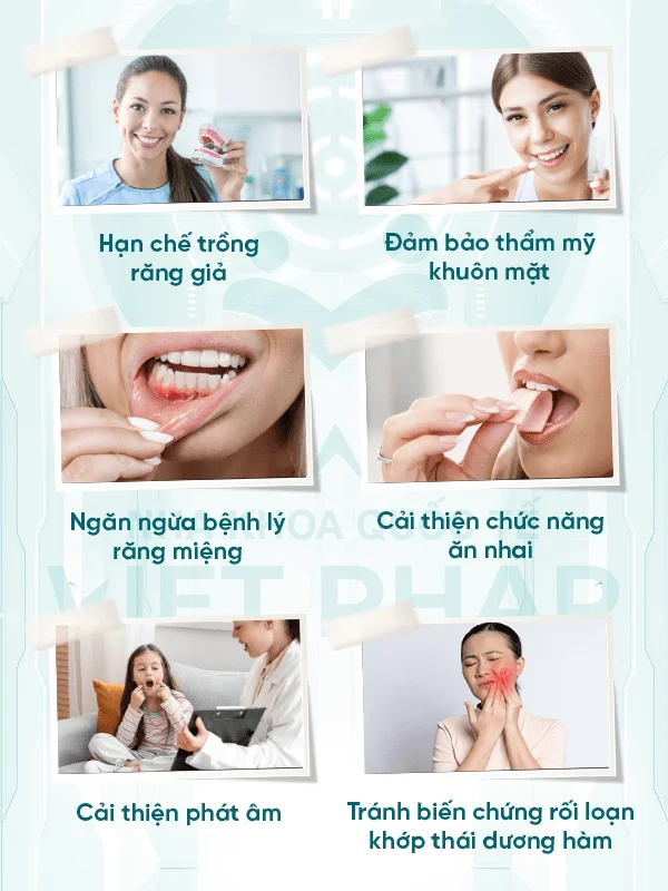 Lợi ích khi niềng răng thẩm mỹ