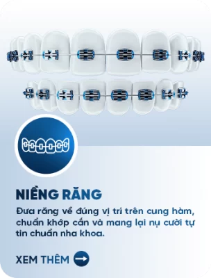niềng răng