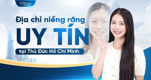 địa chỉ niềng răng uy tín tại Thủ Đức Hồ Chí Minh
