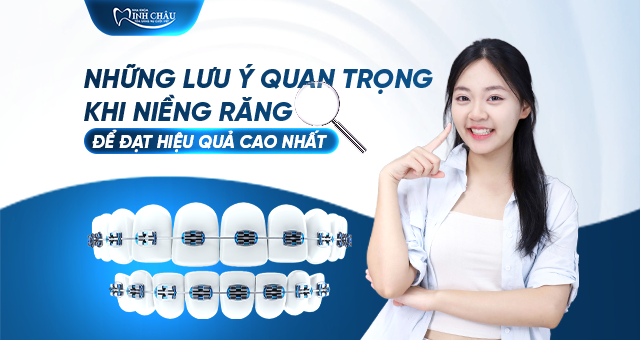 Những Lưu Ý Quan Trọng Khi Niềng Răng