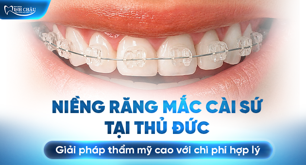 niềng răng mắc cài sứ Thủ Đức