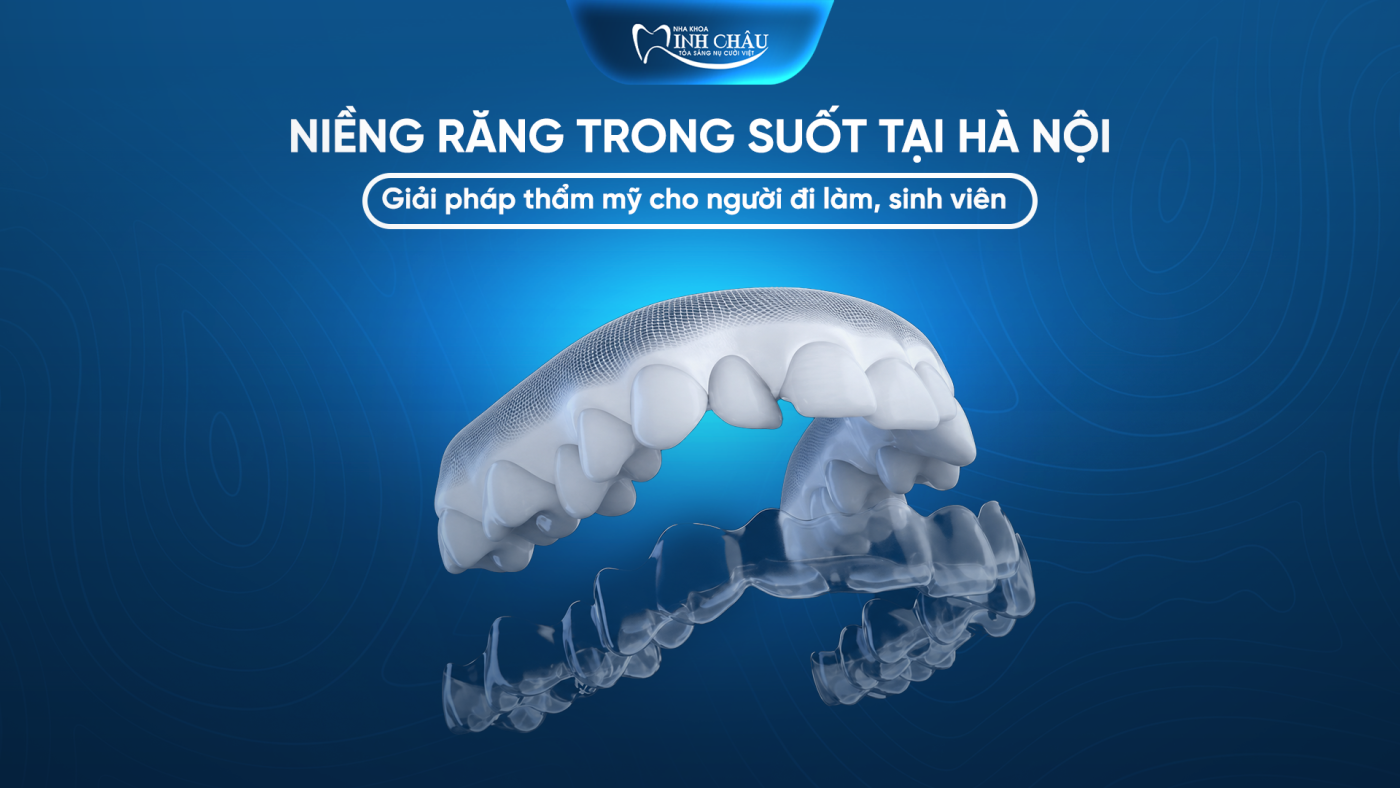 Niềng Răng Trong Suốt Hà Nội Cho Người Đi Làm, Sinh Viên